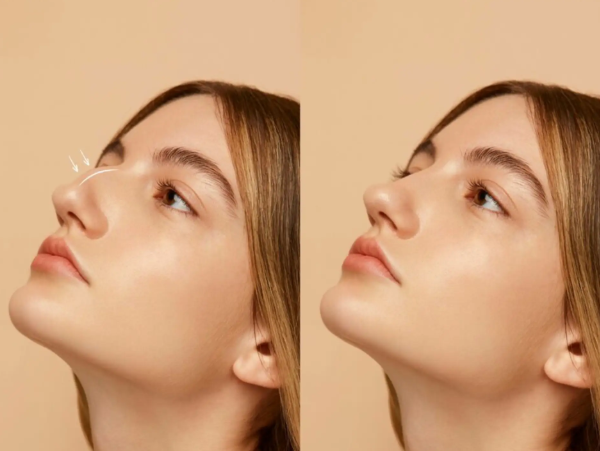 What Makes Dubai the Ideal Choice for Nose Surgery?